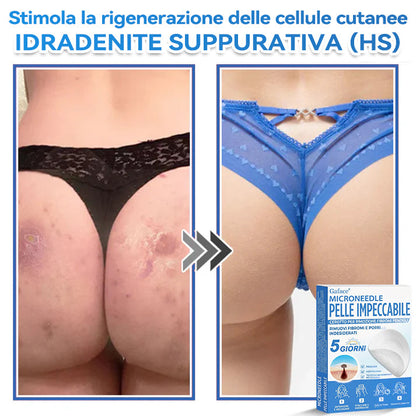 🩹 𝐆𝐚𝐟𝐚𝐜𝐞® 𝐌𝐢𝐜𝐫𝐨𝐧𝐞𝐞𝐝𝐥𝐞 𝐏𝐞𝐥𝐥𝐞 𝐈𝐦𝐩𝐞𝐜𝐜𝐚𝐛𝐢𝐥𝐞 𝐂𝐞𝐫𝐨𝐭𝐭𝐨 𝐏𝐞𝐫 𝐑𝐢𝐦𝐨𝐳𝐢𝐨𝐧𝐞 𝐅𝐢𝐛𝐫𝐨𝐦𝐢 𝐏𝐞𝐧𝐝𝐮𝐥𝐢 | Trattamento per nei in rilievo, acne, verruche piane e fibromi penduli | Attenua rughe, cicatrici e imperfezioni | Cerotti invisibili per brufoli (viso e corpo)🌌🌌