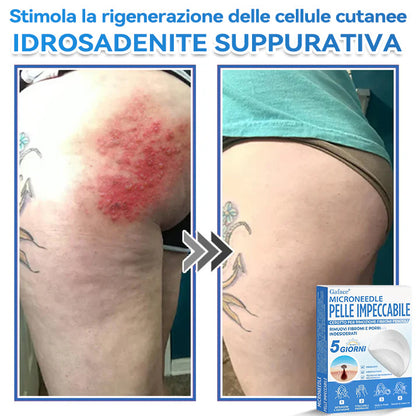 🩹 𝐆𝐚𝐟𝐚𝐜𝐞® 𝐌𝐢𝐜𝐫𝐨𝐧𝐞𝐞𝐝𝐥𝐞 𝐏𝐞𝐥𝐥𝐞 𝐈𝐦𝐩𝐞𝐜𝐜𝐚𝐛𝐢𝐥𝐞 𝐂𝐞𝐫𝐨𝐭𝐭𝐨 𝐏𝐞𝐫 𝐑𝐢𝐦𝐨𝐳𝐢𝐨𝐧𝐞 𝐅𝐢𝐛𝐫𝐨𝐦𝐢 𝐏𝐞𝐧𝐝𝐮𝐥𝐢 | Trattamento per nei in rilievo, acne, verruche piane e fibromi penduli | Attenua rughe, cicatrici e imperfezioni | Cerotti invisibili per brufoli (viso e corpo)🌌🌌