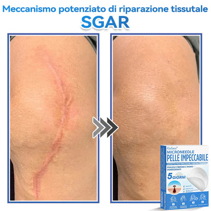 🩹 𝐆𝐚𝐟𝐚𝐜𝐞® 𝐌𝐢𝐜𝐫𝐨𝐧𝐞𝐞𝐝𝐥𝐞 𝐏𝐞𝐥𝐥𝐞 𝐈𝐦𝐩𝐞𝐜𝐜𝐚𝐛𝐢𝐥𝐞 𝐂𝐞𝐫𝐨𝐭𝐭𝐨 𝐏𝐞𝐫 𝐑𝐢𝐦𝐨𝐳𝐢𝐨𝐧𝐞 𝐅𝐢𝐛𝐫𝐨𝐦𝐢 𝐏𝐞𝐧𝐝𝐮𝐥𝐢 | Trattamento per nei in rilievo, acne, verruche piane e fibromi penduli | Attenua rughe, cicatrici e imperfezioni | Cerotti invisibili per brufoli (viso e corpo)🌌🌌