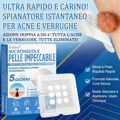 🩹 𝐆𝐚𝐟𝐚𝐜𝐞® 𝐌𝐢𝐜𝐫𝐨𝐧𝐞𝐞𝐝𝐥𝐞 𝐏𝐞𝐥𝐥𝐞 𝐈𝐦𝐩𝐞𝐜𝐜𝐚𝐛𝐢𝐥𝐞 𝐂𝐞𝐫𝐨𝐭𝐭𝐨 𝐏𝐞𝐫 𝐑𝐢𝐦𝐨𝐳𝐢𝐨𝐧𝐞 𝐅𝐢𝐛𝐫𝐨𝐦𝐢 𝐏𝐞𝐧𝐝𝐮𝐥𝐢 | Trattamento per nei in rilievo, acne, verruche piane e fibromi penduli | Attenua rughe, cicatrici e imperfezioni | Cerotti invisibili per brufoli (viso e corpo)🌌🌌