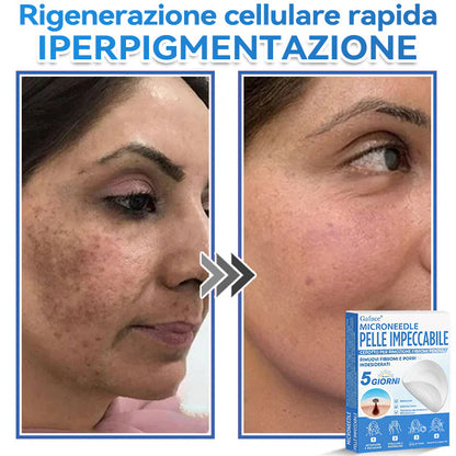 🩹 𝐆𝐚𝐟𝐚𝐜𝐞® 𝐌𝐢𝐜𝐫𝐨𝐧𝐞𝐞𝐝𝐥𝐞 𝐏𝐞𝐥𝐥𝐞 𝐈𝐦𝐩𝐞𝐜𝐜𝐚𝐛𝐢𝐥𝐞 𝐂𝐞𝐫𝐨𝐭𝐭𝐨 𝐏𝐞𝐫 𝐑𝐢𝐦𝐨𝐳𝐢𝐨𝐧𝐞 𝐅𝐢𝐛𝐫𝐨𝐦𝐢 𝐏𝐞𝐧𝐝𝐮𝐥𝐢 | Trattamento per nei in rilievo, acne, verruche piane e fibromi penduli | Attenua rughe, cicatrici e imperfezioni | Cerotti invisibili per brufoli (viso e corpo)🌌🌌